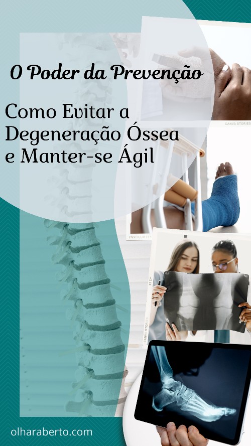 Read more about the article O Poder da Prevenção: Como Evitar a Degeneração Óssea e Manter-se Ágil